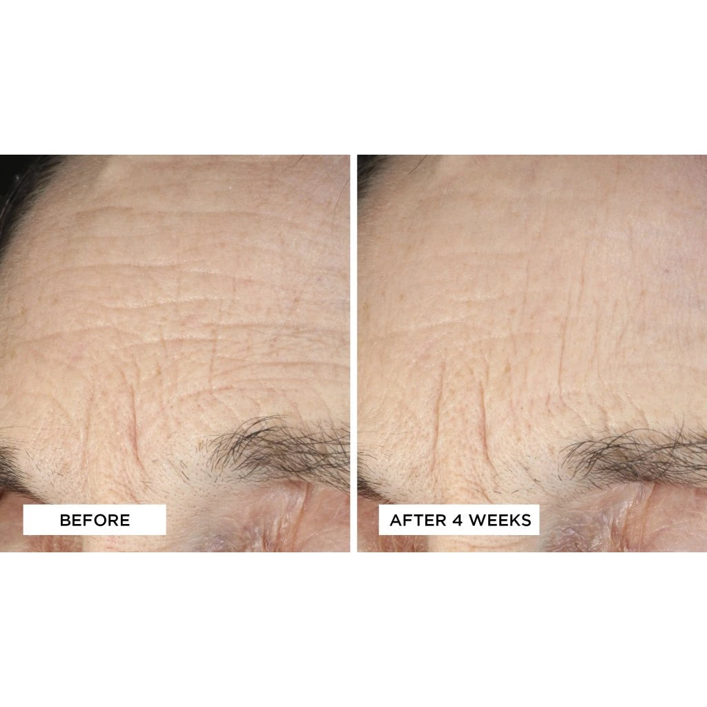 Essential Fx Acyl-Glutathione Deep Crease Serum