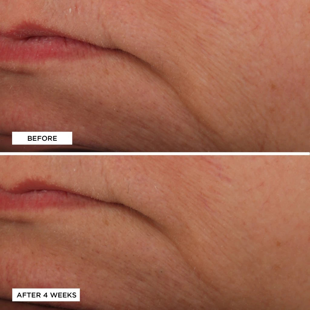 Essential Fx Acyl-Glutathione Rejuvenating Moisturizer