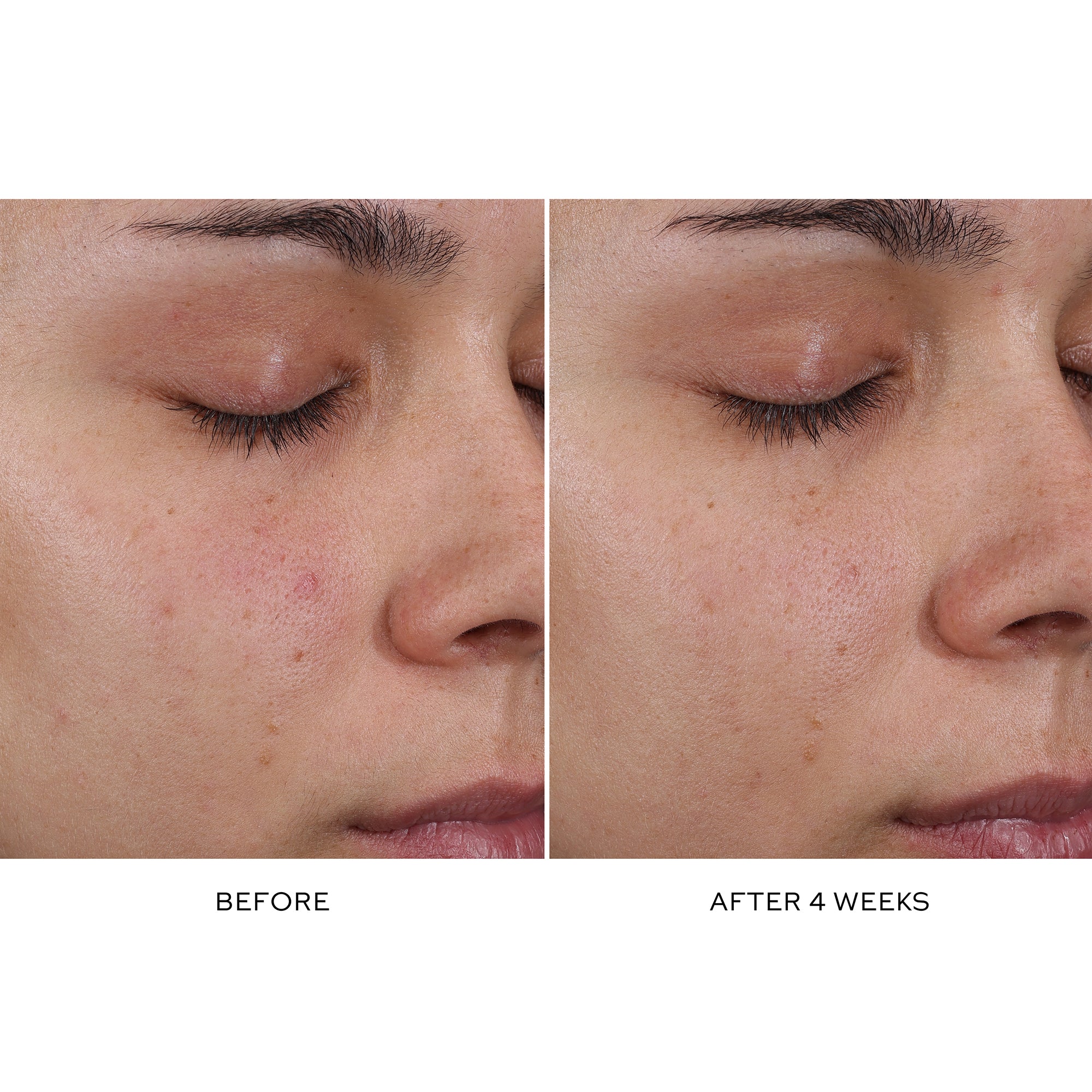 Pore Refining Complex