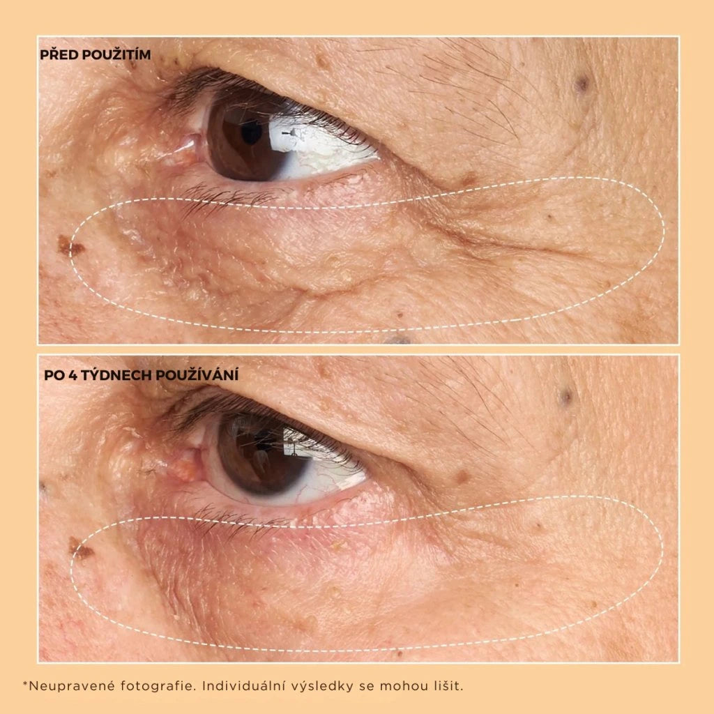Neuropeptide Eyelid Lift Serum