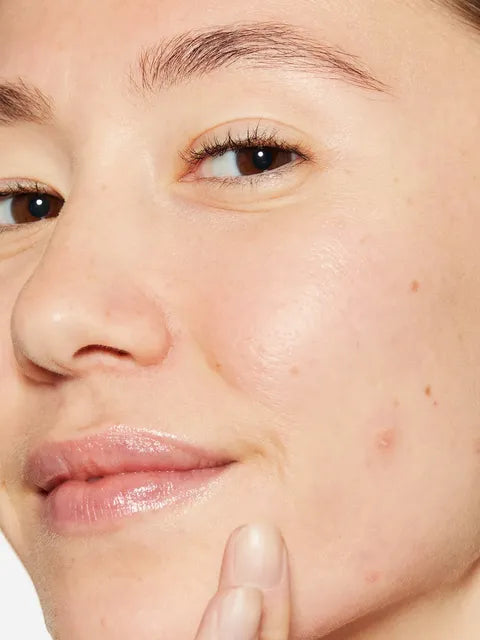Breakout Biotic Moisturizer