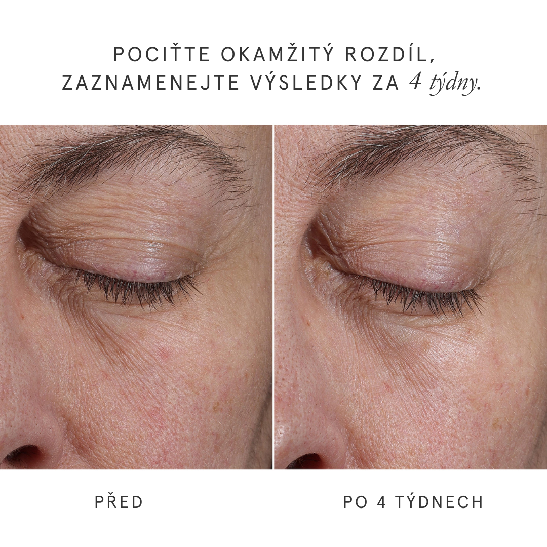 Eye Activator